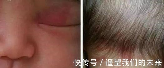 绞痛|宝宝身上的6个“奇怪现象”, 家长有被吓到过吗!