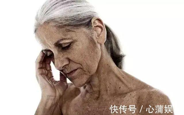 下垂|女性想要衰老来得“慢”，多吃三物，常饮三水，排毒素，延衰老！