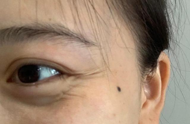 你是“真性皱纹”or“假性皱纹”?从这3点就知道,后者还能拯救