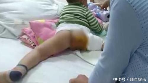 医生|奶奶嫌天热给孙子穿开裆裤，却把娃坑进了医院，医生不怕断后吗