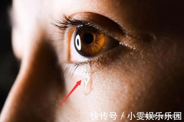 肝功能受损|“肝不干净”,眼睛会“说话”,若有3种“迹象”,肝炎或已来袭