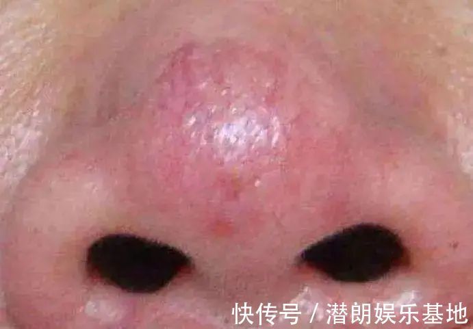 常饮|入秋后,防肺病,多食三物,常饮三水,按揉三处,养好肺,人长寿