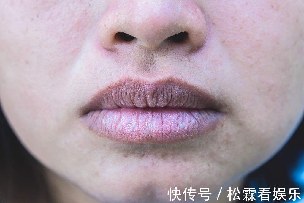 嘴唇|女性有没有妇科疾病,看嘴巴就能够知道,三个特征一眼就能分辨