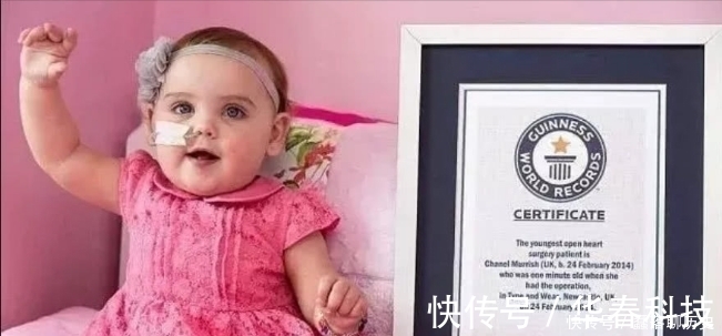 发育不良|吉尼斯世界之最:小宝宝刚刚出生就创下纪录,网友:真是万幸!