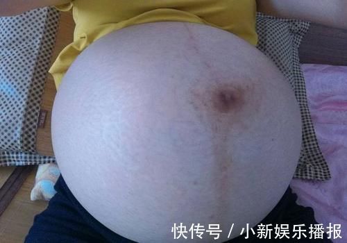 准妈妈|孕晚期肚子下面鼓鼓的是什么,摸起来还疼?