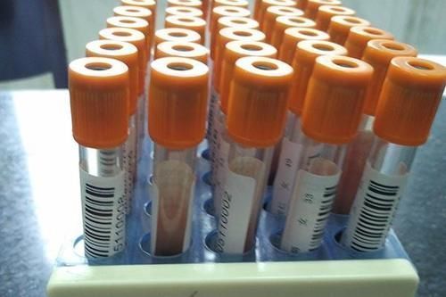 患者|癌症的扩散速度决定患者生存时间?扩散的症状、原因,患者需了解