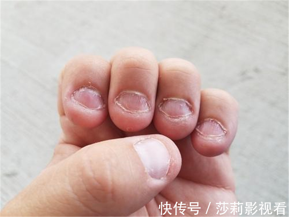 孩子|经常“啃指甲”的孩子,长大后往往逃不出这2种结局,父母要有数