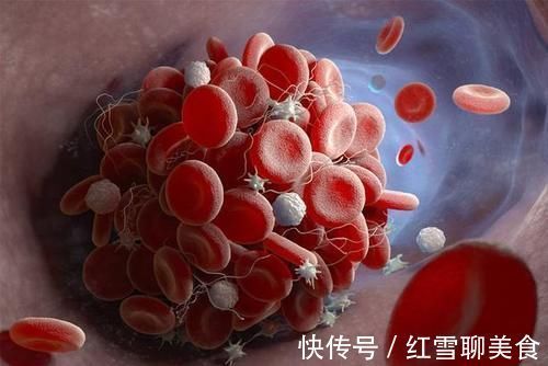 许大姐|血脂升高有哪些变现?若想降脂,学会这“1招”,或让血脂慢慢降