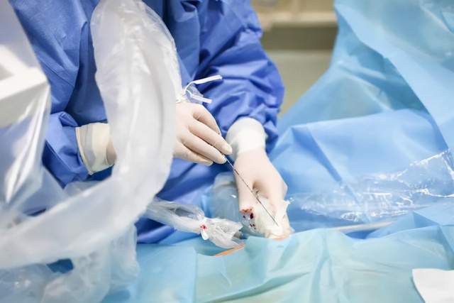 癌细胞|再也不怕癌症了?中国纳秒脉冲电场技术,万伏高压电瞬击癌细胞