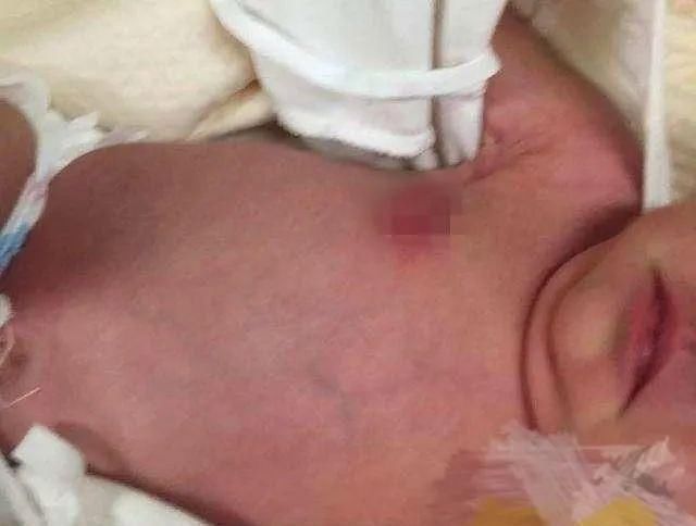 宝宝|宝宝哭闹不止,妈妈掀开衣服后瞬间爆炸:原来是奶奶做了“手脚”