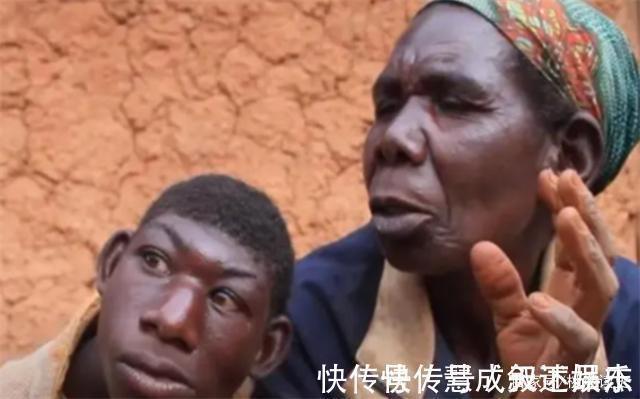 男子|非洲一男子长相似猴子,不吃饭只吃香蕉,常被人当动物欺负