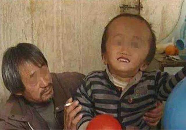 生牛乳|13年前喝过“三鹿奶粉”的孩子们,如今怎样了?有些遗憾终难弥补