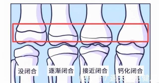 垃圾食品|男童被家人喂到停止发育！医生怒斥：你竟敢给娃吃这个？