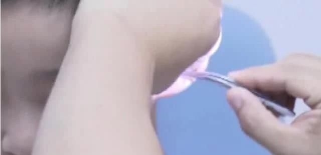耳垢|五岁男孩出生起就没有掏过耳垢结果他第一次掏,花了5000元