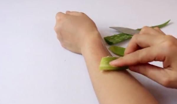 蚊子叮咬|被蚊子咬了又痒又难受,教你3招,不用买药膏,30秒快速止痒