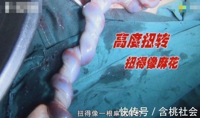 分娩|孕36周后,孕妈有这2种怪怪的“变化”,恭喜你,是胎儿入盆了