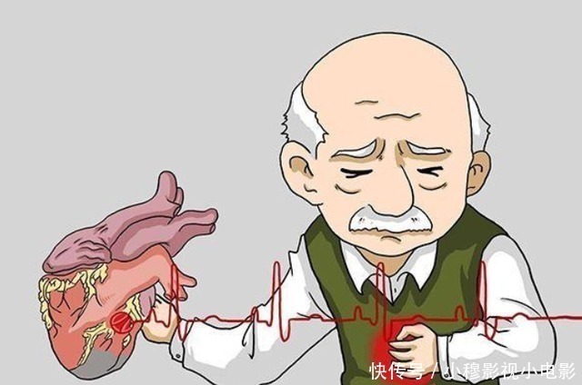 血压|高血压不能吃韭菜?医生建议:想要稳定血压,这3种素食尽量少吃