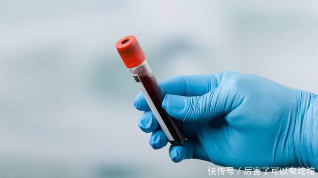 血脂超标的人不能吃鸡蛋?错!其实要撤下餐桌的是这4类食物