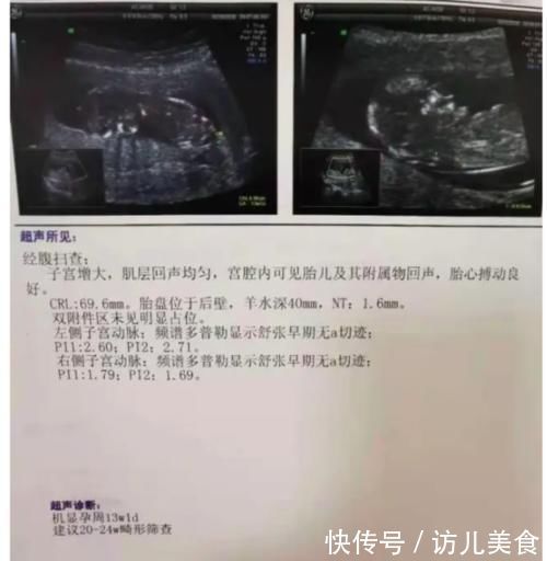 胎位|孕期做几次B超?各B超单信息代表什么?孕妈要搞清楚