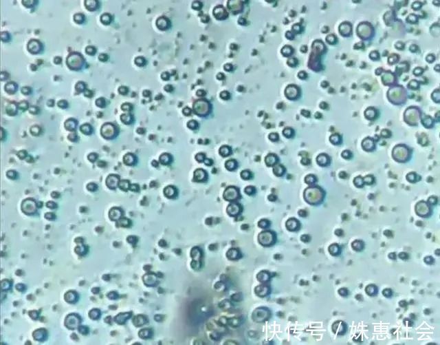 六个月|母乳在显微镜下放大一千倍竟是活的,让人惊叹:母爱的伟大!