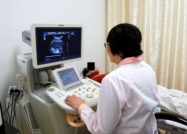 胎儿|孕期第几周能看出“胎儿性别”这个时间段，B超医生一眼能看出
