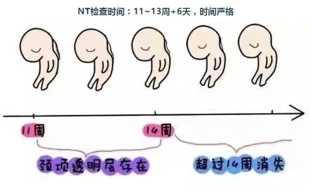 小宁|胎儿智力有问题，孕妈会有什么特点？有4个关键问题孕妈要问自己