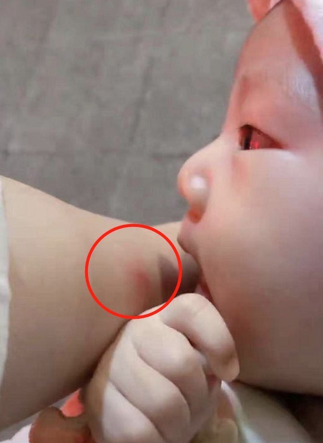 乳房|喂母乳到底有多疼？宝妈用手臂做了实验，网友：心疼妈妈们