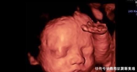 怀孕期间|孕期做四维有什么好处,什么时候做最好这个时候做是最好的