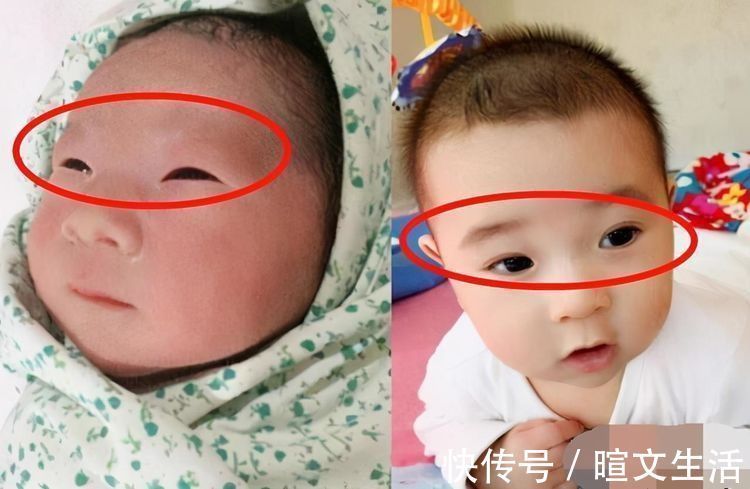 肿眼泡|婴儿的眼睛不随着年龄而长大别纠结了,做好3点娃的眼睛更漂亮