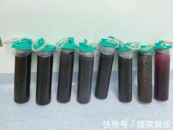 囊肿|13岁女生肚子隆起爬满“妊娠纹”,照完CT妈妈当场吓懵