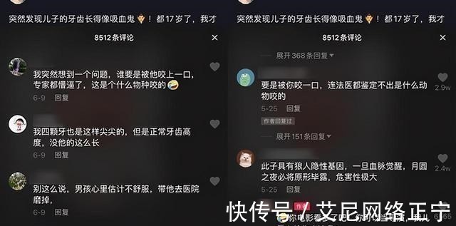 刷牙|17岁儿子长尖牙,亲妈吐槽像“吸血鬼”,网友:也可能是个狼人