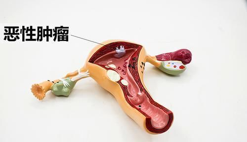 耳朵出现异常褶皱或是暗示人体心脏出现问题，中医教你如何鉴别