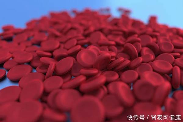 为什么生活条件变好了还会有贫血?肾友贫血该怎么办?