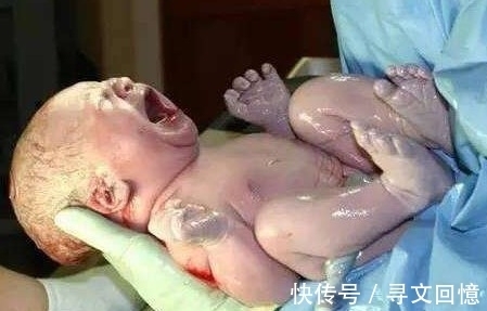 幼儿园|宝宝贴着避孕环出生，医生说发育受影响，上幼儿园后才知道真相