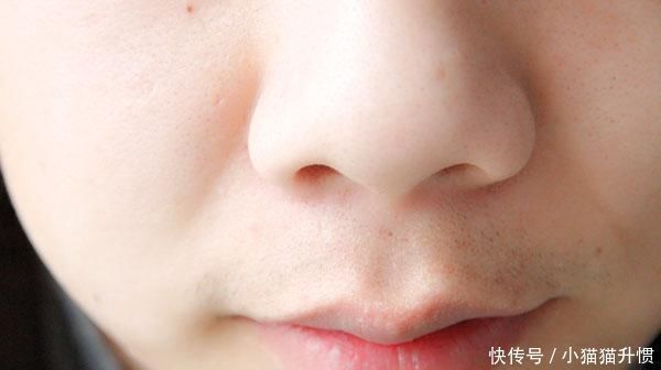 鼻子上可以挤出很多白色的膏状,挤了很多年,毛孔越来越大怎么办