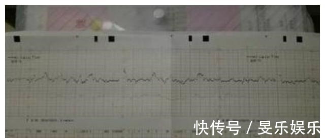 b超单|孕检时,若怀的是男宝宝,多数会有这3种孕检结果,你都符合吗?