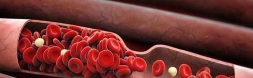 血栓|脑供血不足,跟4个原因脱不了关系,常吃一物,血管通,供血足