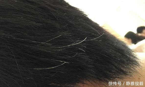 黑色素|白头发,真的是会拔一根长十根?怎么做,可让你拥有一头乌黑头发