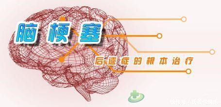 脑血管堵塞的前兆是什么专家说这3个前兆没有引起大家重视!