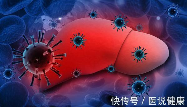 晨起|晨起3个表现找上你时,不要以为只是疲劳,或是肝脏生病的信号