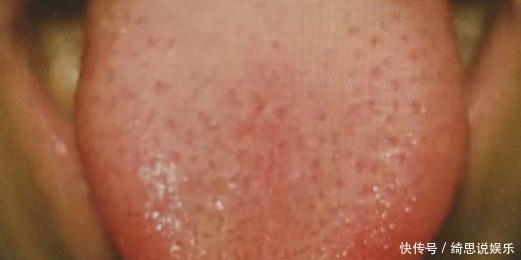 手上有个“救心穴”,长期按一下,心脏血管也就通了