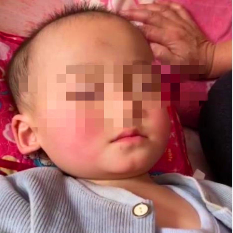 抢救|一岁男童吃错药,陷入昏迷,抢救后脑死亡,父母无奈放弃治疗