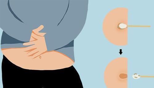 影响|肚脐里又黑又臭的泥,到底是什么?直接抠掉,对身体有什么影响?