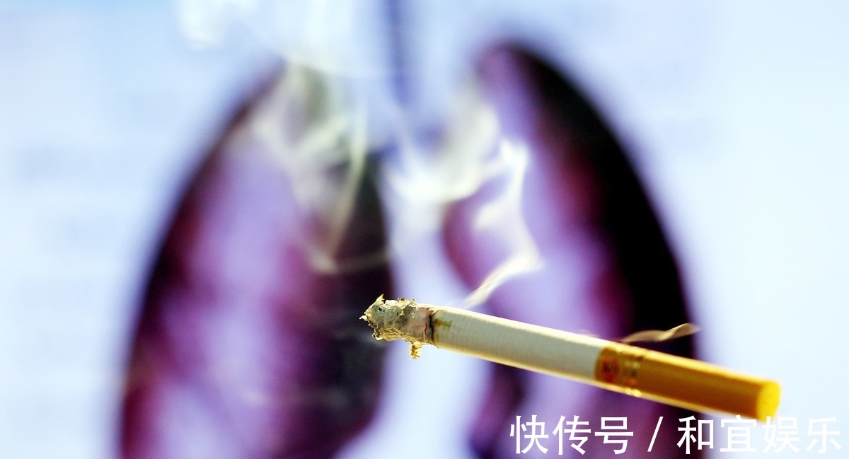 非小细胞肺癌|晚期肺癌不能手术,还有这些方法可选择,可延长生命提高生活质量