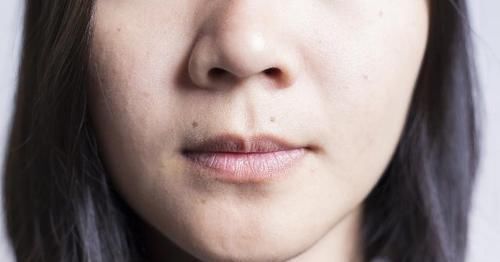 卵巢|女人有没有妇科病，看嘴就能明白，若有表现，十有八九是找上你了