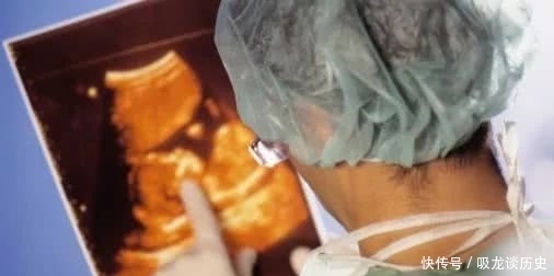 试管婴儿|试管婴儿反复失败问题到底出在哪?该继续还是坚持?