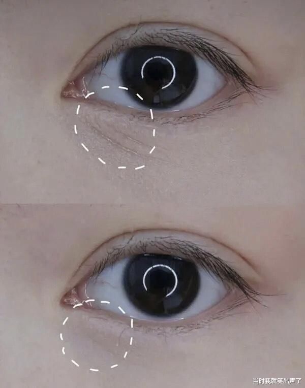 黑眼圈|建议女人,涂眼霜时要注意这3点“误区”,否则眼霜再贵也没效果