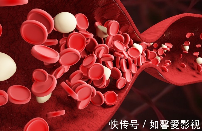 奶制品|高血脂的人不能喝奶制品?医生提醒:不想血脂升高,做好这3点