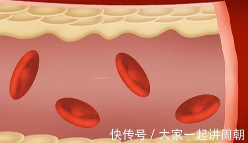 不饱和脂肪酸|血脂高不能吃肉医生：3种肉适量吃，有助降脂，防止动脉硬化