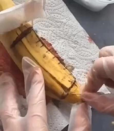 过程|剖腹产真的很轻松吗?看完“香蕉产妇”的分娩过程,或许你会改观